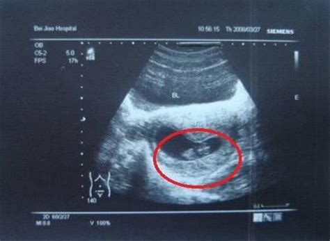 8周的胎儿是什么样子的