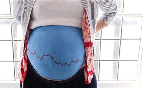 孕期没有胆汁淤积症却痒痒的厉害是怎么回事