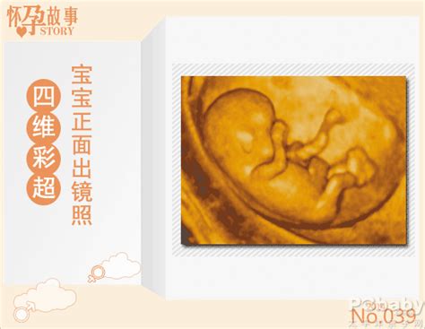头胎剖腹产二胎引产后多久可以怀孕