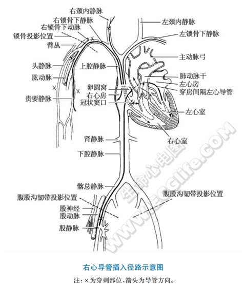 四维检查心脏静脉导管异常