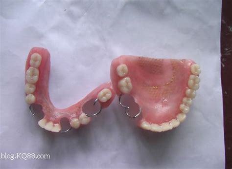 修补树脂假牙