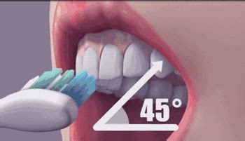 每天刷完牙用漱口水吗