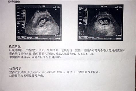 孕9周胎囊大小对照表