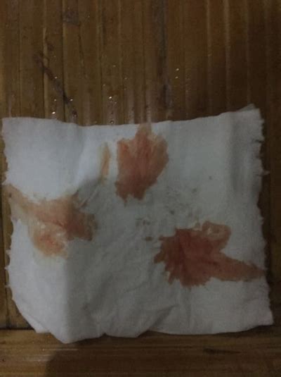 38周肚子痛又见红又宫缩