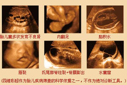 胎儿期发育的影响因素