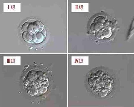 移植囊胚10天白板翻盘