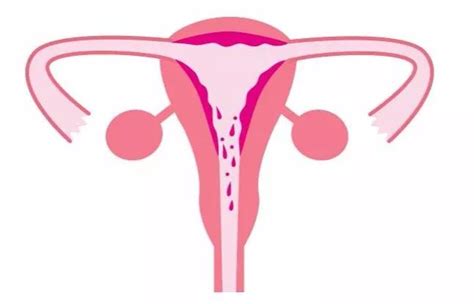 女生子宫内膜太薄有什么影响
