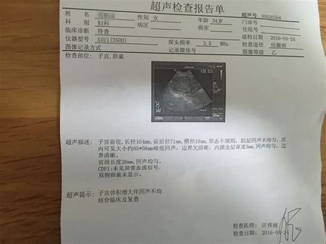 子宫肌瘤会导致不孕不育吗