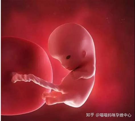 孕9周胎儿什么样子图片