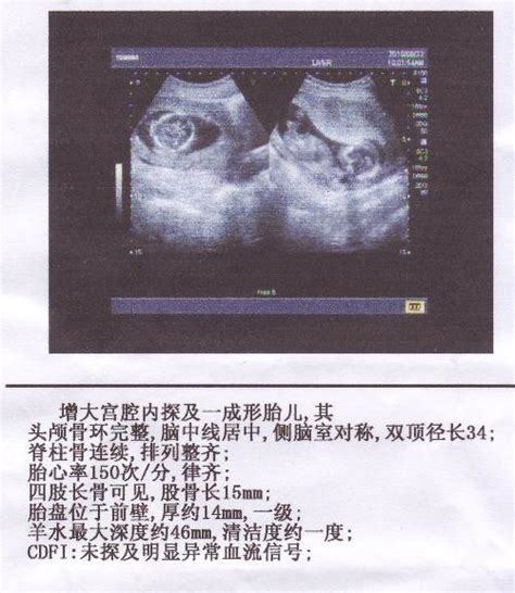 三个月的胎儿的胎教