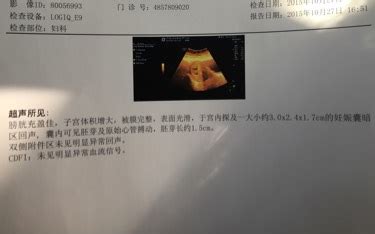 怀孕多久可以见胎心