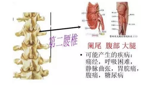 左侧髋骨及部分腰椎多发致密结节