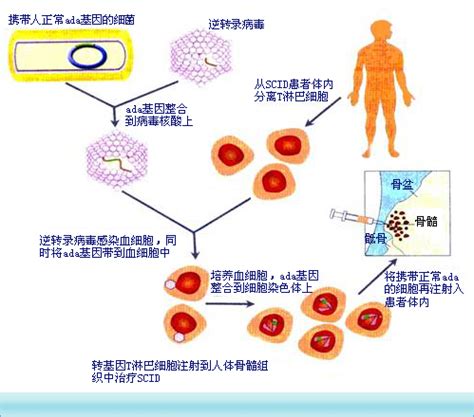 hiv最新治愈研究消息