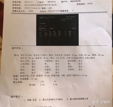 唐筛结果多久可以拿到