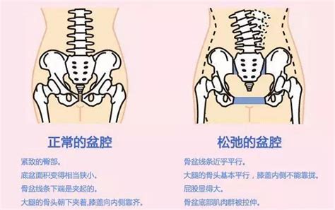 孕早期得痔疮是怀男孩吗