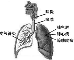 气管炎症状及表现