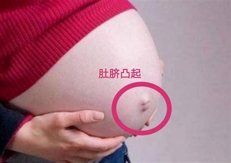 怀孕的肚脐眼照片