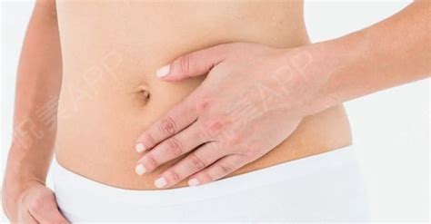 妊娠纹是怎么形成的要怎么样预防