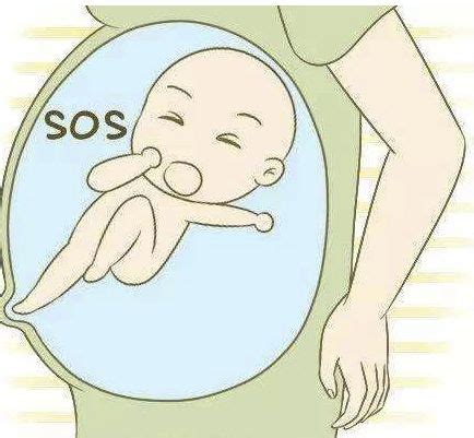 宫内宝宝缺氧胎心率是多少