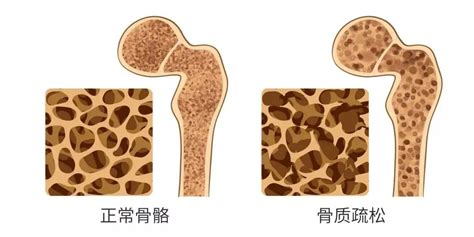 碳酸氢钠片有助于怀孕吗