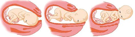 月经正常怀双胎几率