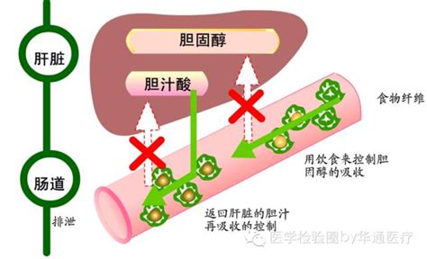 新生儿总胆汁酸39严重吗