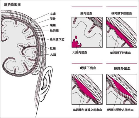 什么原因会导致下体持续出血