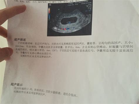 怀孕约7周是哪天受孕的