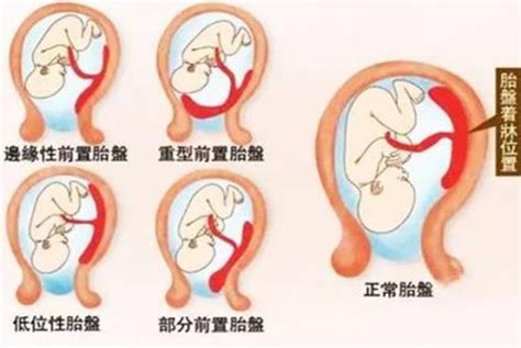 怀孕注意事项和饮食禁忌列表