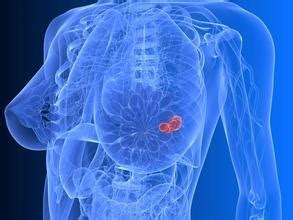 有乳房纤维瘤怀孕了怎么办