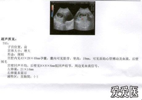孕35周胎儿股骨长标准值