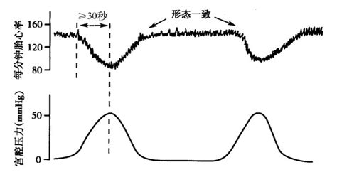 预产期胎心变化快