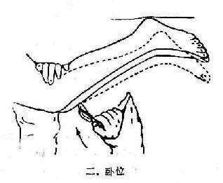 膝胸卧位的视频教程图