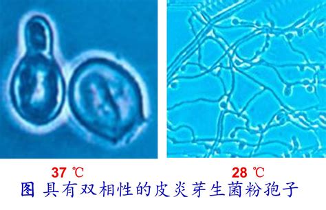 酵母菌假菌丝阳性