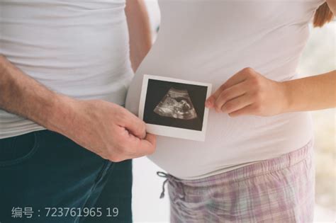 胎儿有哪些畸形是查不出来的