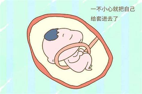 孕妇如何预防胎儿畸形