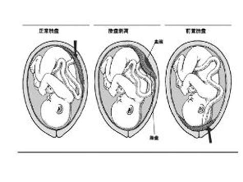 人体胎盘的功效与作用